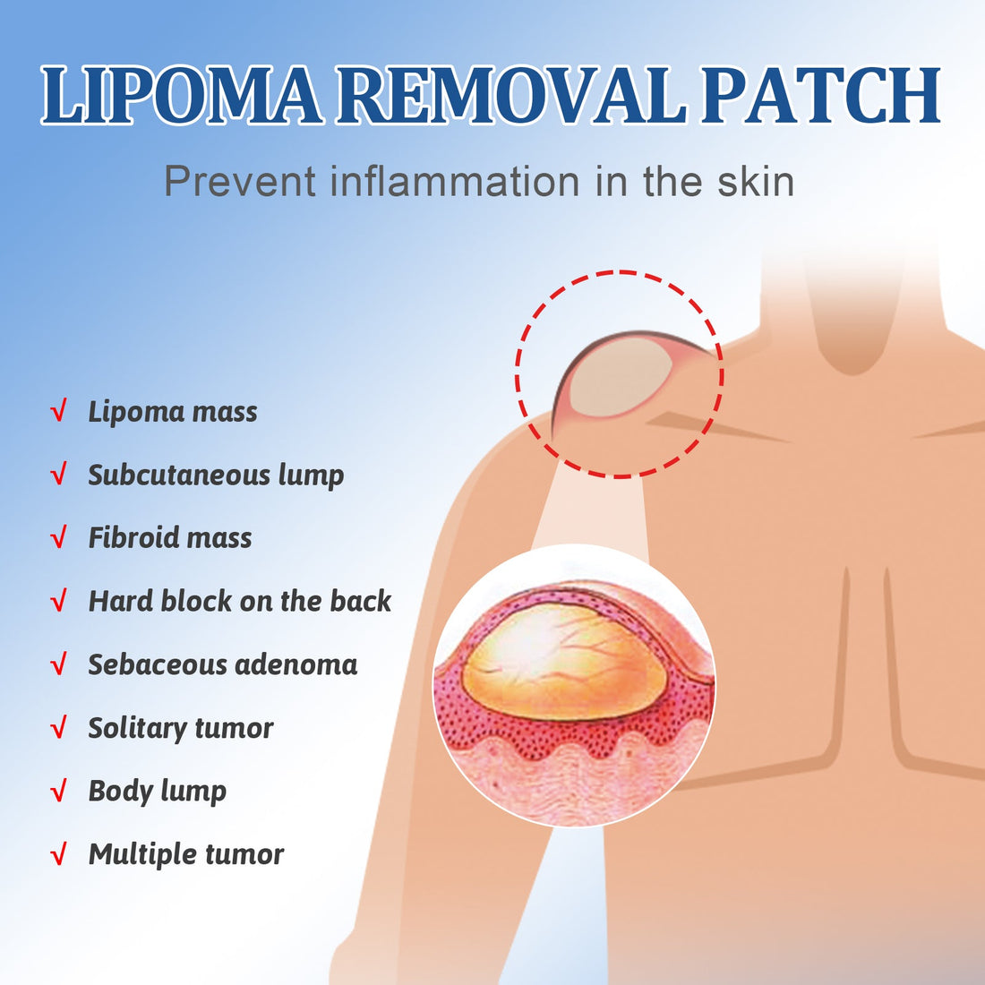 Lipoma Removal Patch – Subcutaneous Lump Care